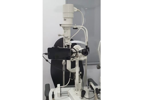 Biomicroscopio o lámpara de hendidura